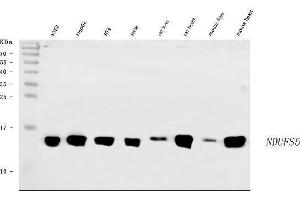 Western blot analysis of NDUFS5 using anti-NDUFS5 antibody (ABIN7598943).