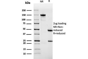 SDS-PAGE Analysis Purified Sarcomeric Actinin Alpha 2 Mouse MAb (ACTN2/3291).