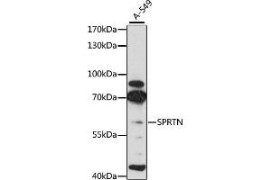 Western blot analysis of extracts of A-549 cells, using SPRTN antibody (ABIN6131456, ABIN6148389, ABIN6148391 and ABIN6215355) at 1:3000 dilution. (Spartan anticorps  (AA 1-240))