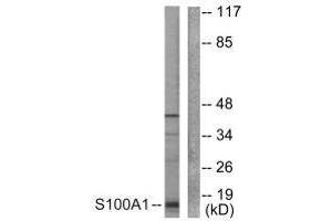 Western blot analysis of extracts from A549 cells, using S100 A1 antibody. (S100A1 anticorps)