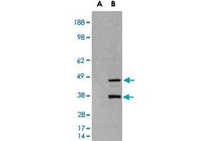 HEK293 overexpressing SIRT3 and probed with SIRT3 polyclonal antibody  (mock transfection in first lane), tested by Origene. (SIRT3 anticorps)