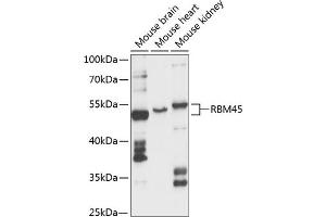 Western blot analysis of extracts of various cell lines, using RBM45 antibody (ABIN6128634, ABIN6146784, ABIN6146785 and ABIN6217980) at 1:3000 dilution. (RBM45 anticorps  (AA 1-300))