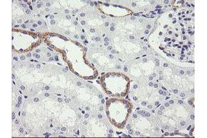 Image no. 1 for anti-NADPH Dependent Diflavin Oxidoreductase 1 (NDOR1) antibody (ABIN1499655)