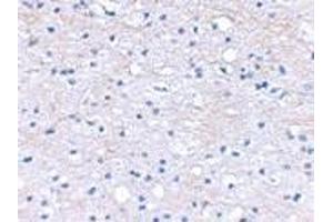 anti-Hyaluronan and Proteoglycan Link Protein 2 (HAPLN2) (Center) antibody