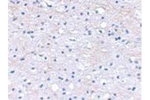 Immunohistochemical staining of human brain tissue using AP30163PU-N BRAL1 antibody at 2. (HAPLN2 anticorps  (Center))