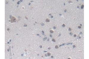Detection of MTHFR in Human Cerebrum Tissue using Polyclonal Antibody to Methylenetetrahydrofolate Reductase (MTHFR)
