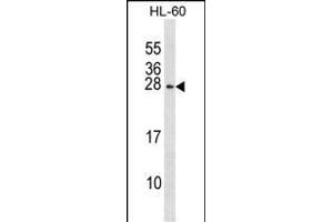 RGS2 Antibody (N-term) (ABIN1881749 and ABIN2839036) western blot analysis in HL-60 cell line lysates (35 μg/lane). (RGS2 anticorps  (N-Term))