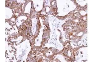 anti-Pantothenate Kinase 1 (PANK1) antibody