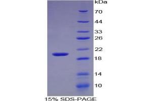 SDS-PAGE of Protein Standard from the Kit (Highly purified E. (IL-17 Kit CLIA)
