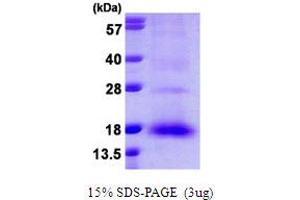 SDS-PAGE (SDS) image for NTF2-Related Export Protein 1 (NXT1) (AA 1-140) protein (His tag) (ABIN667905)