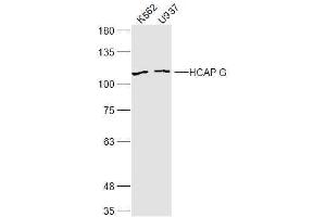Lane 1: K562 lysates Lane 2: U937 lysates probed with HCAP G Polyclonal Antibody, Unconjugated  at 1:300 dilution and 4˚C overnight incubation. (NCAPG anticorps  (AA 161-170))