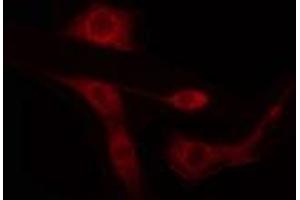 ABIN6274434 staining LOVO cells by IF/ICC. (ARID1B anticorps  (Internal Region))