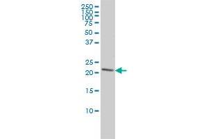 PRDX2 monoclonal antibody (M01), clone 4E10-2D2 Western Blot analysis of PRDX2 expression in Hela . (Peroxiredoxin 2 anticorps  (AA 1-198))