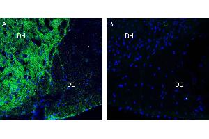 Expression of Neurofascin in rat spinal cord. (NFASC anticorps  (C-Term, Intracellular))