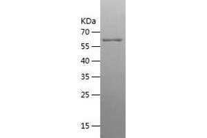 Western Blotting (WB) image for Creatine Kinase, Brain (CKB) (AA 1-381) protein (His-IF2DI Tag) (ABIN7122490)