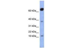 Image no. 1 for anti-NK6 Homeobox 3 (NKX6-3) (AA 71-120) antibody (ABIN6742923) (NK6 Homeobox 3 anticorps  (AA 71-120))