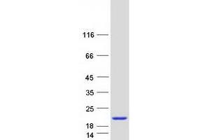Validation with Western Blot