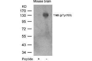 Image no. 1 for anti-Neurotrophic Tyrosine Kinase, Receptor, Type 2 (NTRK2) (pTyr705) antibody (ABIN319265) (TRKB anticorps  (pTyr705))