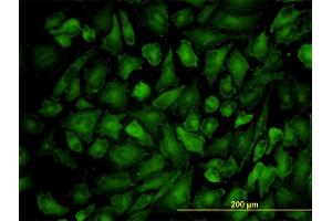 Immunofluorescence of monoclonal antibody to VCL on HeLa cell. (Vinculin anticorps  (AA 1-1066))