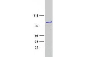 Validation with Western Blot