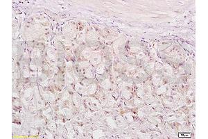 Formalin-fixed and paraffin embedded mouse stomach labeled with Anti-XAF1/FBXO39 Polyclonal Antibody, Unconjugated (ABIN674754) at 1:200 followed by conjugation to the secondary antibody and DAB staining.