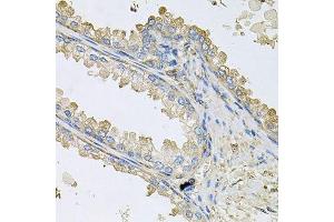 Immunohistochemistry of paraffin-embedded human prostate using PPIC antibody.