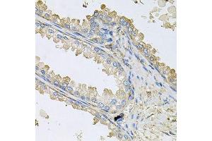 Immunohistochemistry of paraffin-embedded human prostate using PPIC antibody. (PPIC anticorps  (AA 23-212))