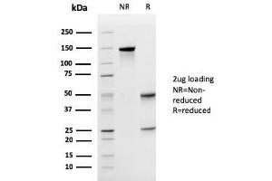 SDS-PAGE Analysis Purified Uroplakin 1A Mouse Monoclonal Antibody (UPK1A/2925).