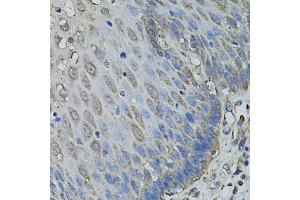 Immunohistochemistry of paraffin-embedded human esophagus using IL1A antibody (ABIN6291332) at dilution of 1:100 (40x lens). (IL1A anticorps)
