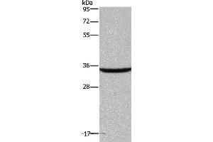 Western blot analysis of Human fetal brain tissue, using DKK3 Polyclonal Antibody at dilution of 1:200 (DKK3 anticorps)