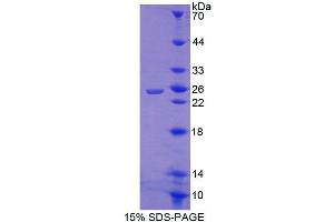 SDS-PAGE analysis of Human CRTC1 Protein.