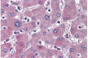 Human Liver (formalin-fixed, paraffin-embedded) stained with ABCB11 antibody ABIN305775 at 5 ug/ml followed by biotinylated anti-mouse IgG secondary antibody ABIN481714, alkaline phosphatase-streptavidin and chromogen.