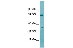 KHK antibody used at 1 ug/ml to detect target protein. (Ketohexokinase anticorps)