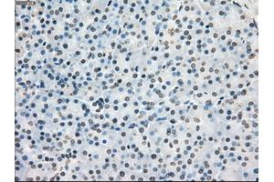 Immunohistochemical staining of paraffin-embedded Adenocarcinoma of colon tissue using anti-PORmouse monoclonal antibody. (POR anticorps)