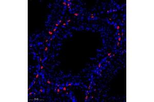Immunofluorescence of paraffin embedded mouse testis using PP4R2 (ABIN7075284) at dilution of 1:1000 (280x lens)