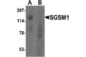 Western blot analysis of SGSM1 in human cerebellum tissue lysate with SGSM1 Antibody  at 1 μg/ml in (A) the absence and (B) the presence of blocking peptide. (SGSM1 anticorps  (Middle Region))