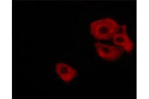 ABIN6267697 staining MKN-45 cells treated with Forskolin 30 μM, 20 min by ICC/IF. (DARPP32 anticorps  (pThr34))