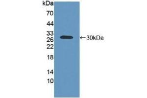 Detection of Recombinant ABCC2, Human using Polyclonal Antibody to ATP Binding Cassette Transporter C2 (ABCC2) (ABCC2 anticorps  (AA 1300-1534))