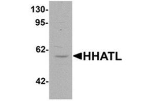 Western blot analysis of HHATL in 3T3 cell lysate with HHATL antibody at 1 ug/mL. (HHATL anticorps  (N-Term))