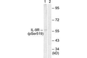 Western blot analysis of extracts from HuvEc cells, using IL-9R (Phospho-Ser519) Antibody. (IL9 Receptor anticorps  (pSer519))