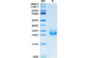 CD7 (CD7) (AA 24-150) protein (His tag)