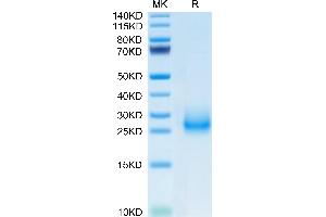 Mouse CD7 on Tris-Bis PAGE under reduced condition. (CD7 Protein (CD7) (AA 24-150) (His tag))