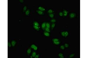Immunofluorescent analysis of HepG2 cells using ABIN7145825 at dilution of 1:100 and Alexa Fluor 488-congugated AffiniPure Goat Anti-Rabbit IgG(H+L)