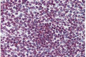 Human Spleen: Formalin-Fixed, Paraffin-Embedded (FFPE) (FOXO3 anticorps  (AA 361-460))