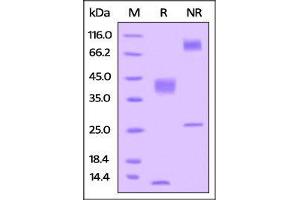 Human Latent TGFB1, His Tag on SDS-PAGE under reducing (R) and no-reducing (NR) conditions. (TGFB1 Protein (AA 30-390) (His tag))