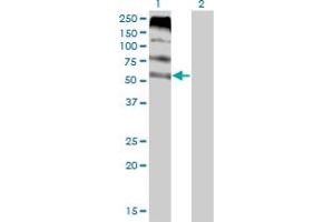 Western Blot analysis of FLVCR expression in transfected 293T cell line by FLVCR monoclonal antibody (M05), clone 4B2. (FLVCR anticorps  (AA 1-83))