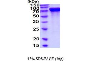 SDS-PAGE (SDS) image for Meprin A, beta (MEP1B) (AA 21-654) protein (His tag) (ABIN6387778)