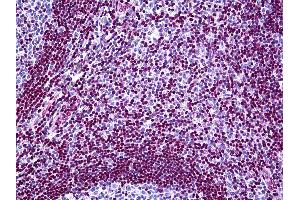 Anti-MECP2 antibody IHC of human tonsil. (MECP2 anticorps  (AA 81-170))