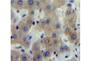 Used in DAB staining on fromalin fixed paraffin-embedded Liver tissue (FCN1 anticorps  (AA 25-317))