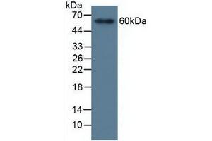 Detection of MMP19 in Human Serum using Polyclonal Antibody to Matrix Metalloproteinase 19 (MMP19) (MMP19 anticorps  (AA 98-508))